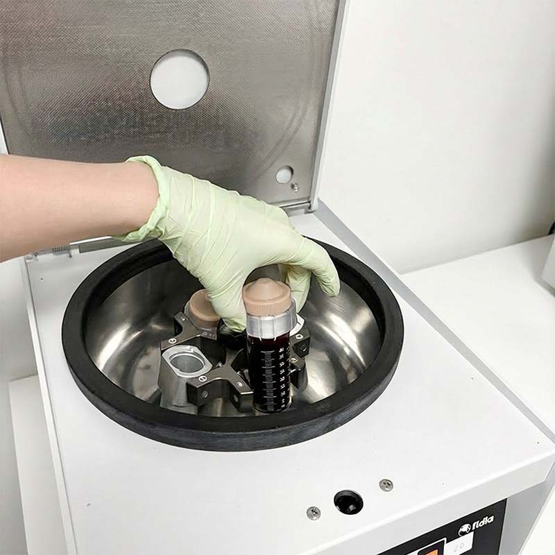 Centrifugeuse de préparation PRP